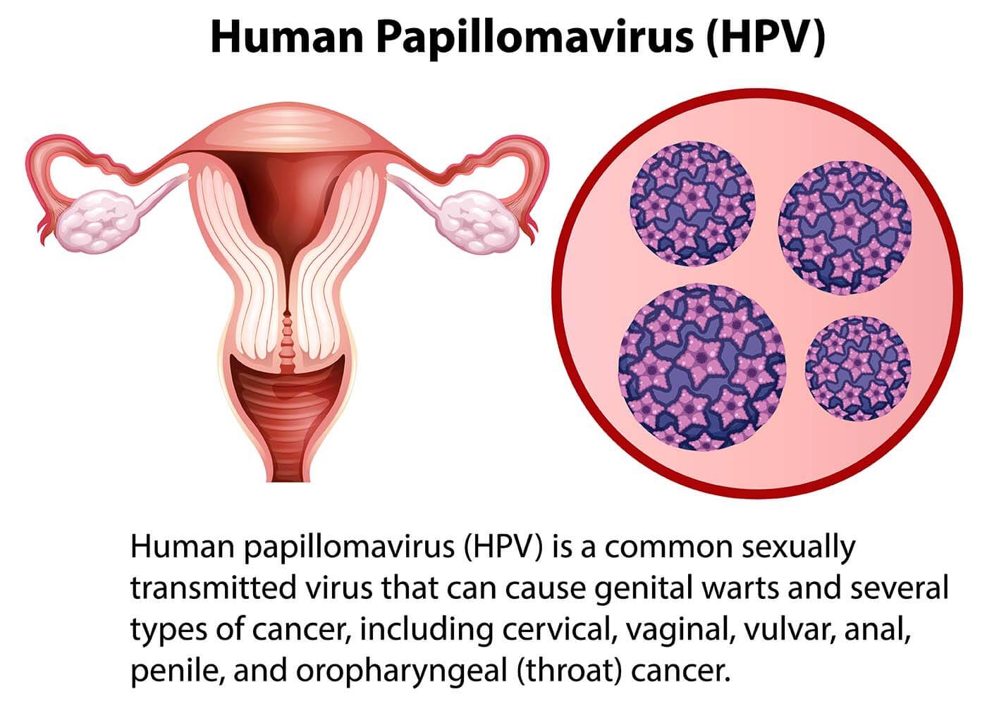 hpv vaccine great barr private