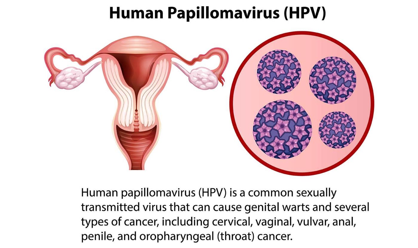 hpv vaccine great barr private