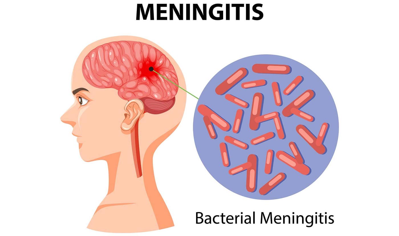 meningitis vaccination near me in great barr