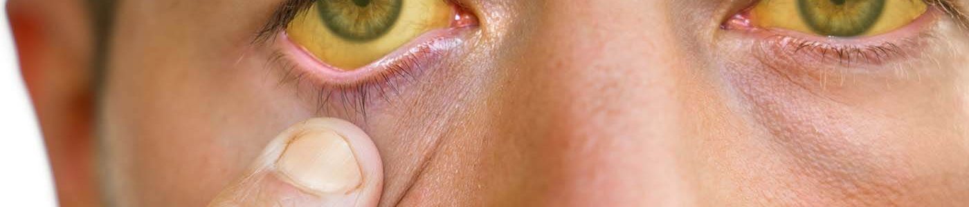 hepatitis a vaccine great barr service