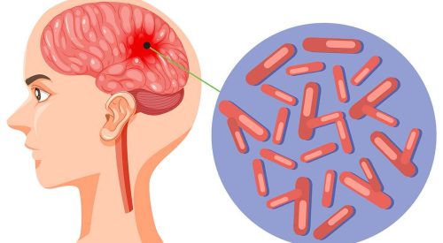 meningitis vaccination near me in great barr